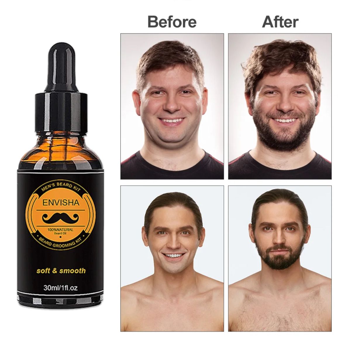 Beard growth kit